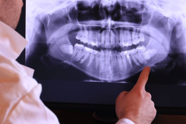 Best Pediatric Emergency Dentist in Lakemoor, IL